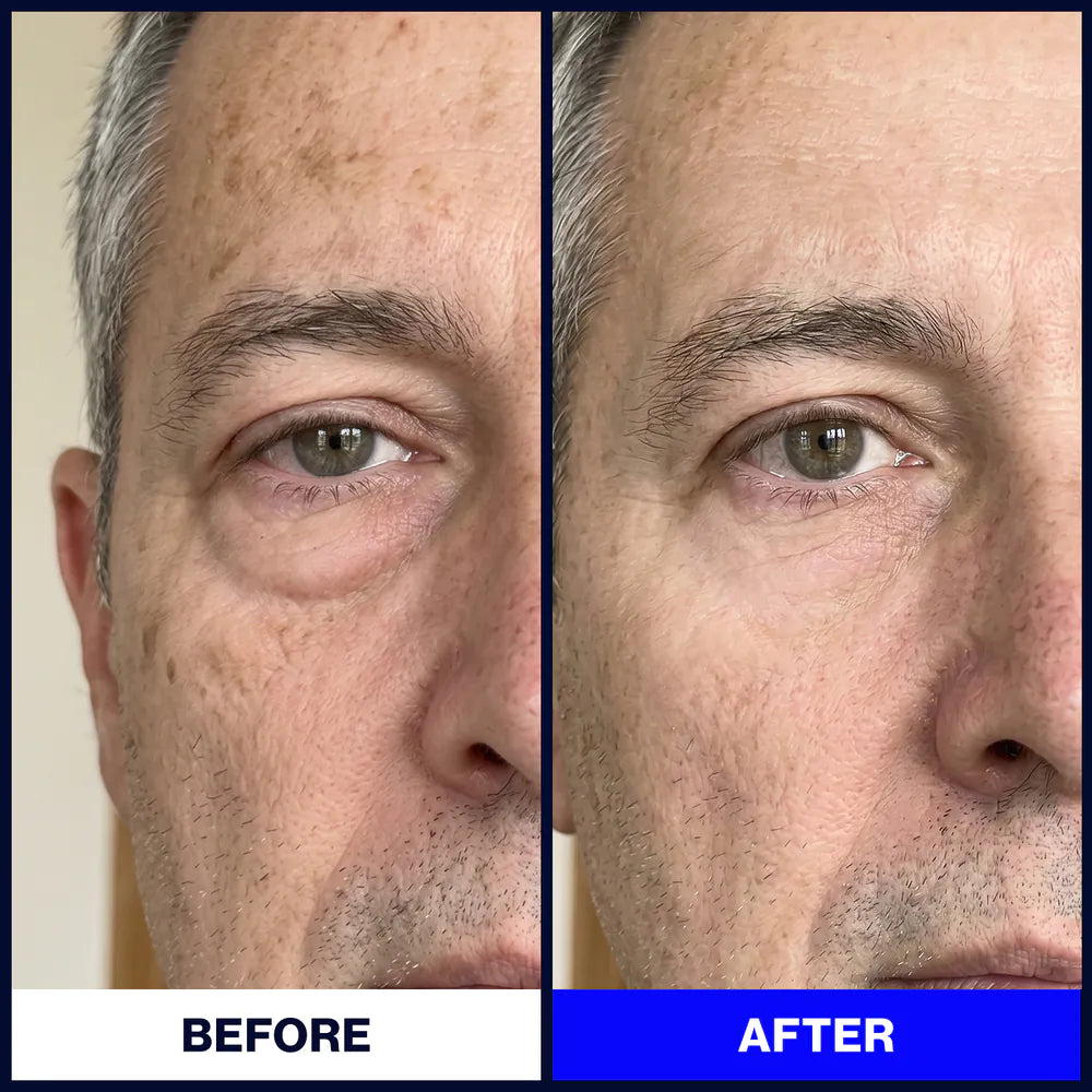 Particle-Face Cream