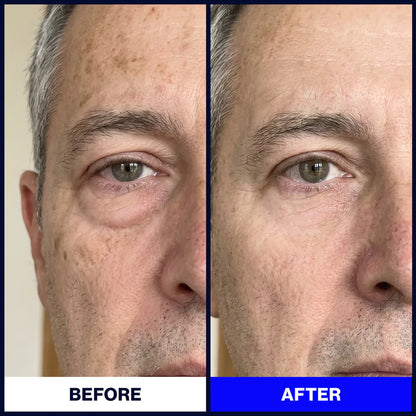 Particle-Face Cream